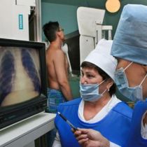 Изменен закон о лечении туберкулеза: основные нововведения 