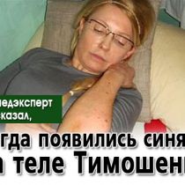 Судмедэксперт рассказал, когда появились синяки на теле Тимошенко
