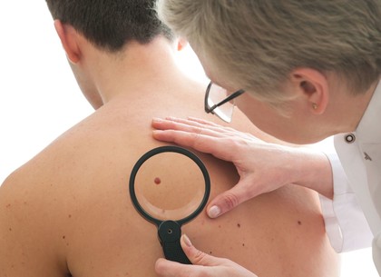 Харьковчане смогут бесплатно провериться на рак кожи