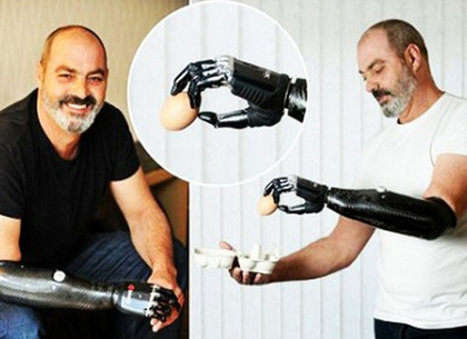 Украина начнет производить бионические протезы рук для участников АТО