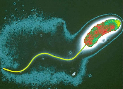 В озере под Харьковом обнаружили холерный вибрион