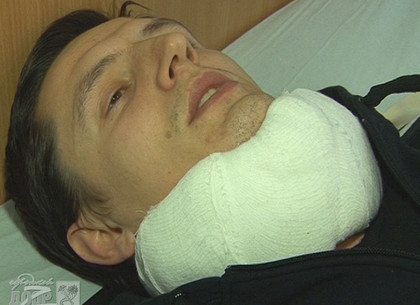 У избитого журналиста «Харьковских Известий» диагностировали ушибы внутренних органов (ФОТО)