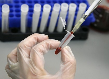 Гепатит под Харьковом: в окружении заболевших есть новые заразившиеся