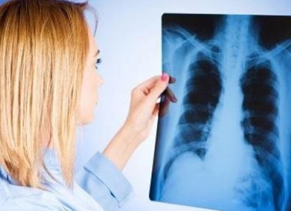 Количество заболеваний туберкулезом в Харькове уменьшилось