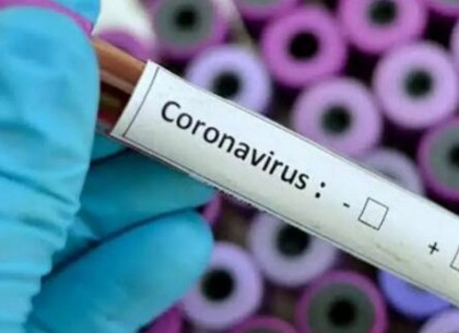 Найближчим часом Харків отримає тест-системи на коронавірус
