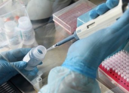 Новое оборудование для диагностики коронавируса скоро появится в Харькове