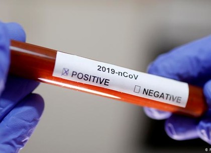 Еще у четверых медиков подвердили коронавирус: статистика заболеваний за сутки