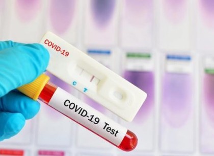 У Харкові зафіксовано близько 1,7 тисячі випадків захворювання на коронавірус