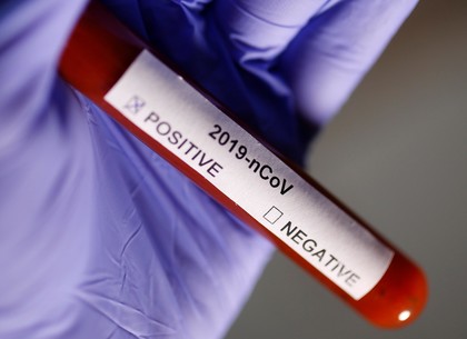 У Харкові зафіксовано понад дві тисячі випадків захворювання на коронавірус