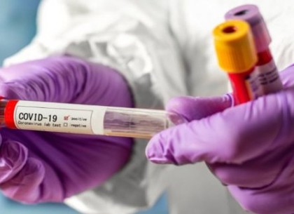 Понад 2050 випадків захворювання на коронавірус зафіксовано в Харкові
