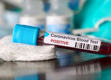 У Харкові - 71 новий випадок захворювання на коронавірус