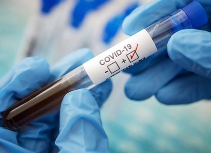 У Харкові - 173 нових випадки захворювання на коронавірус