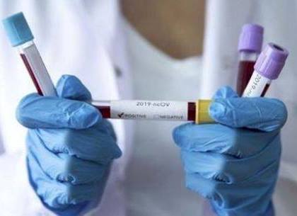 Новый антирекод по коронавирусу: 9 человек скончались, 546 новых случаев