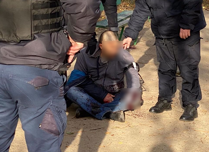 ВИДЕО: В районе Одесской неизвестный взорвал три гранаты и лишился кисти руки (Telegram)