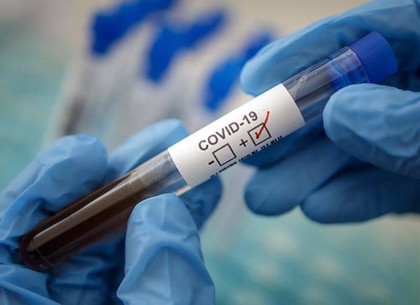 В Харькове – 489 новых случаев заболевания коронавирусом (ХГС)