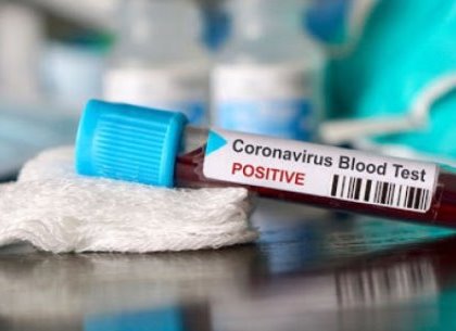 Новый рекорд смертности от коронавируса: за сутки болезнь унесла 14 жизней – ХОГА