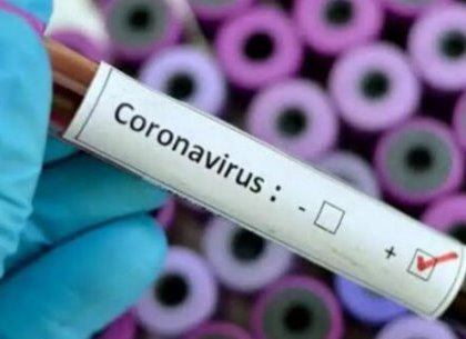 От коронавируса за сутки умерли 9 человек: статистика на 23 декабря – ХОГА