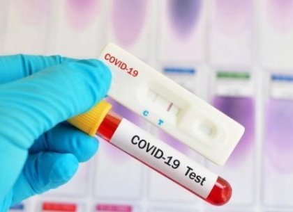 В Харькове – 128 новых случая заболевания коронавирусом: статистика на 16 мая