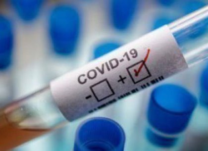 Сколько случаев заболевания коронавирусом зафиксировано в Харькове за сутки: статистика на 31 августа