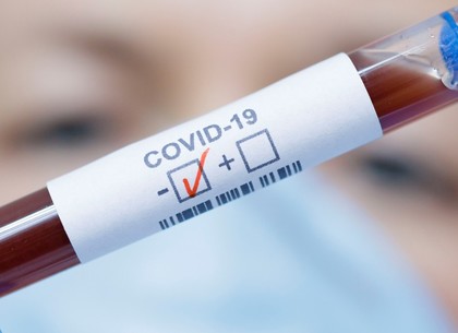 В Харькове определили первые признаки коллективного иммунитета против COVID-19