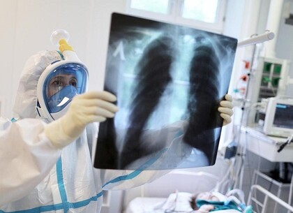 Covid-19 в Харькове: за сутки выявлено 963 новых больных