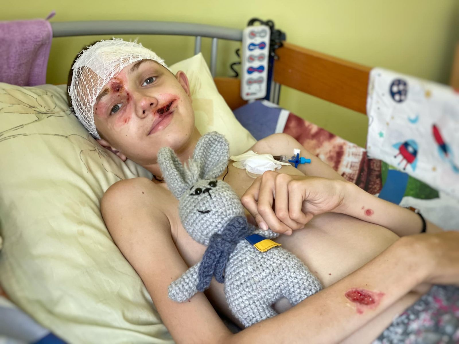 Новини Харкова: 12-річному Стасу з Грушувахи зробили краніопластику у Львові