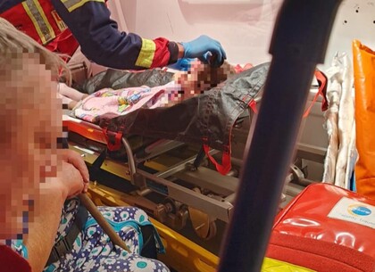 У ХОВА поінформували про стан дівчинки, яка постраждала під час ворожого удару по Харківщині