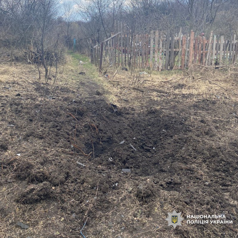 Новини Харкова: дитина постраждала від обстрілу