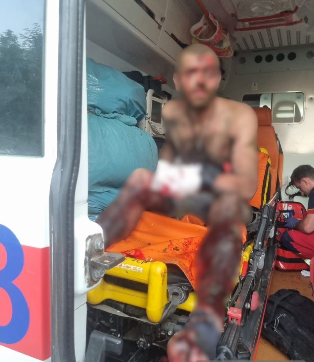 Новини Харкова: чоловік підірвався на вибухівці біля Слатиного